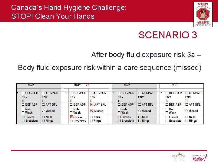 Canada’s Hand Hygiene Challenge: STOP! Clean Your Hands SCENARIO 3 After body fluid exposure