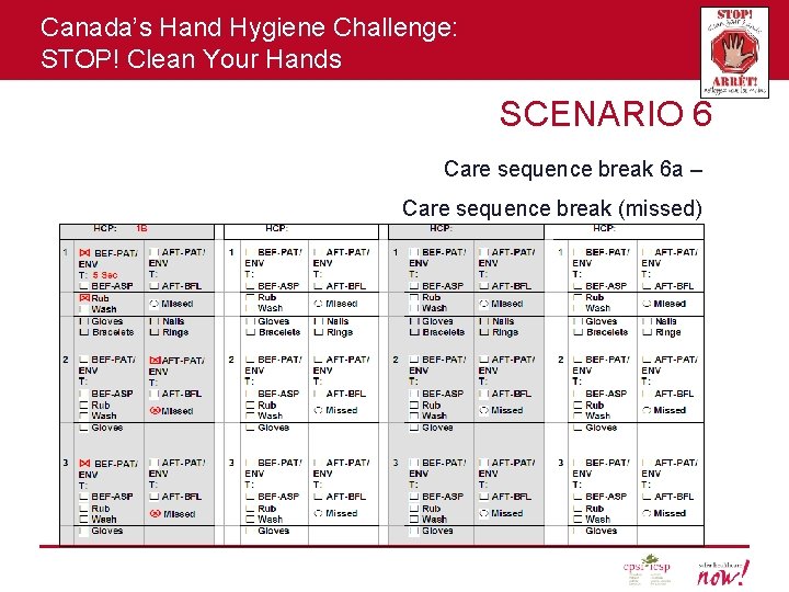 Canada’s Hand Hygiene Challenge: STOP! Clean Your Hands SCENARIO 6 Care sequence break 6