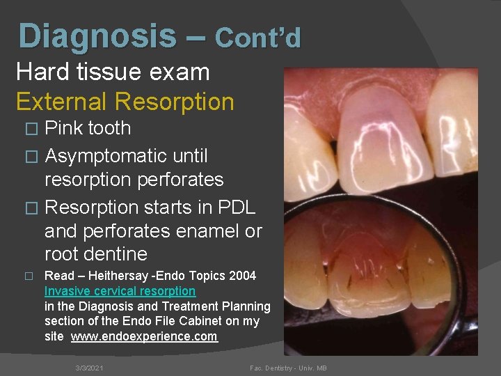 Diagnosis – Cont’d Hard tissue exam External Resorption Pink tooth � Asymptomatic until resorption