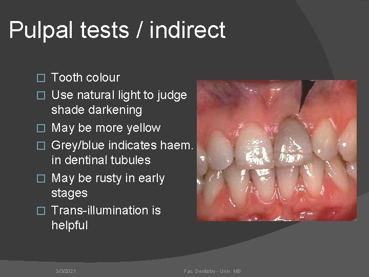 Pulpal tests / indirect � � � Tooth colour Use natural light to judge
