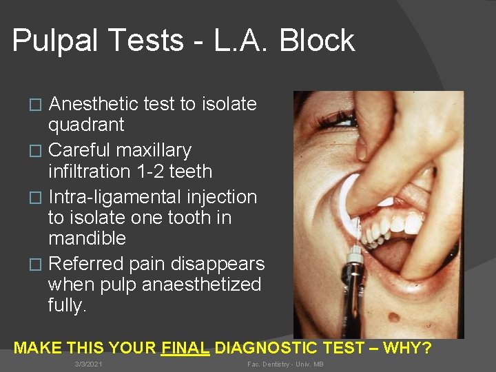 Pulpal Tests - L. A. Block Anesthetic test to isolate quadrant � Careful maxillary