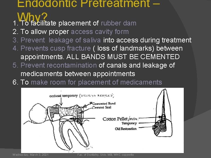 Endodontic Pretreatment – Why? 1. To facilitate placement of rubber dam 2. To allow