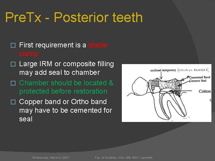 Pre. Tx - Posterior teeth First requirement is a stable clamp � Large IRM