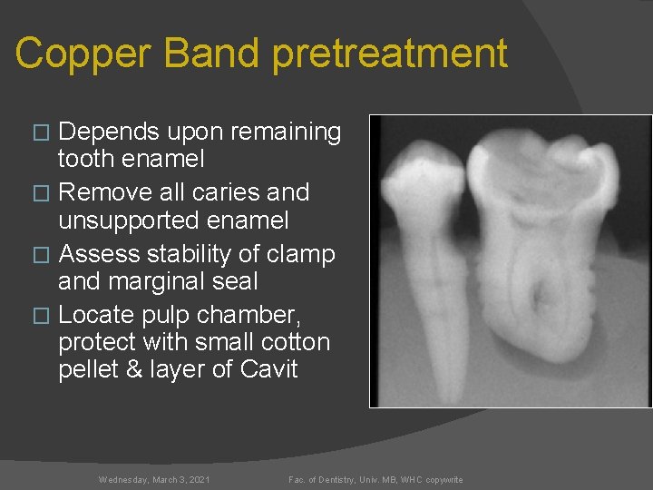 Copper Band pretreatment Depends upon remaining tooth enamel � Remove all caries and unsupported