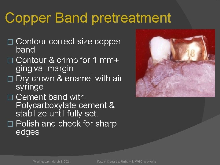 Copper Band pretreatment Contour correct size copper band � Contour & crimp for 1