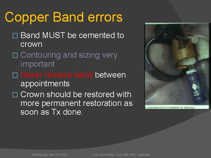 Copper Band errors Band MUST be cemented to crown � Contouring and sizing very