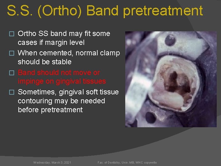 S. S. (Ortho) Band pretreatment Ortho SS band may fit some cases if margin