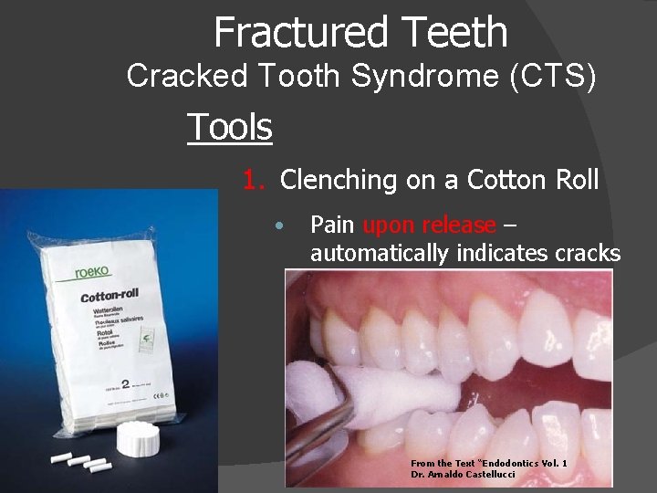 Fractured Teeth Cracked Tooth Syndrome (CTS) Tools 1. Clenching on a Cotton Roll •