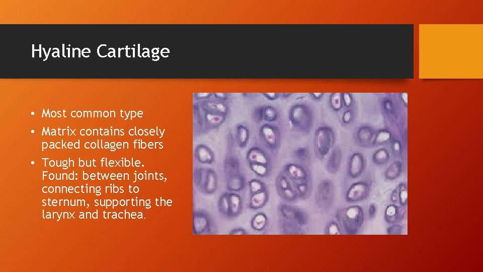 Hyaline Cartilage • Most common type • Matrix contains closely packed collagen fibers •