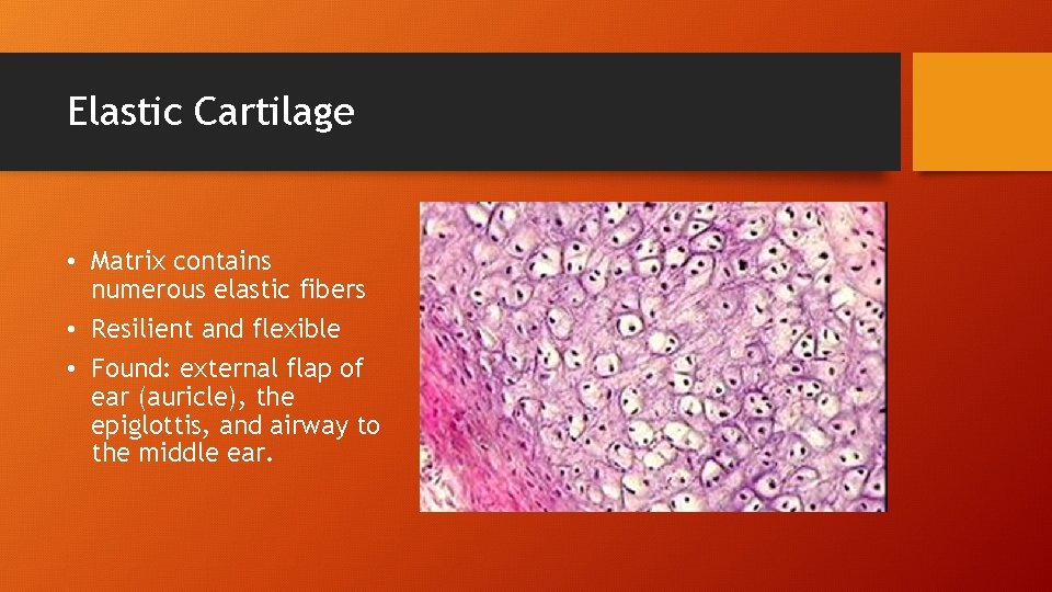 Elastic Cartilage • Matrix contains numerous elastic fibers • Resilient and flexible • Found: