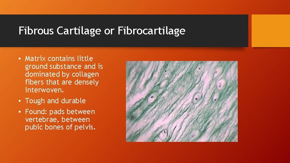 Fibrous Cartilage or Fibrocartilage • Matrix contains little ground substance and is dominated by