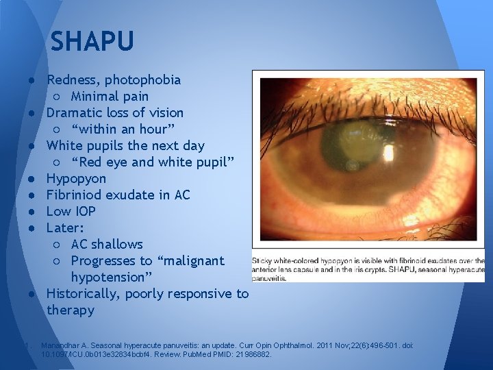 SHAPU ● Redness, photophobia ○ Minimal pain ● Dramatic loss of vision ○ “within SHAPU ● Redness, photophobia ○ Minimal pain ● Dramatic loss of vision ○ “within
