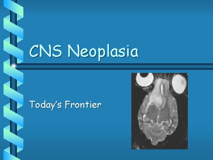 CNS Neoplasia Today’s Frontier 