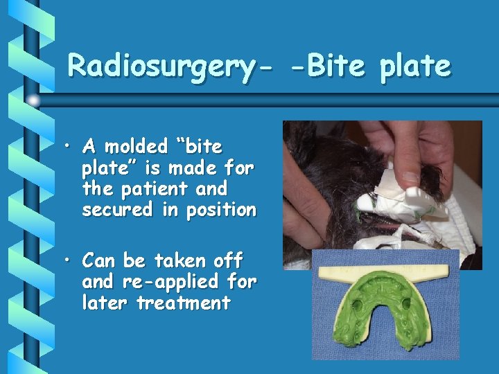 Radiosurgery- -Bite plate • A molded “bite plate” is made for the patient and