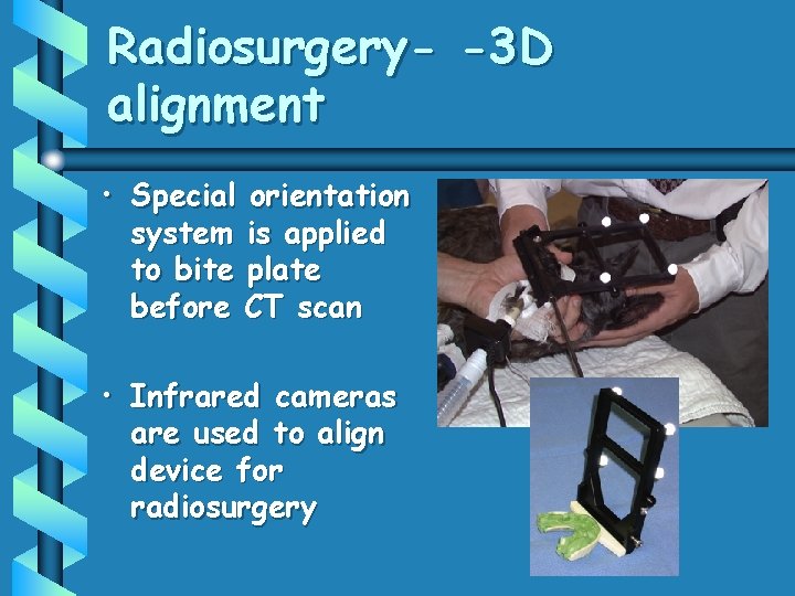 Radiosurgery- -3 D alignment • Special orientation system is applied to bite plate before