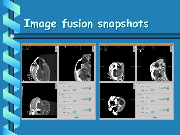 Image fusion snapshots 