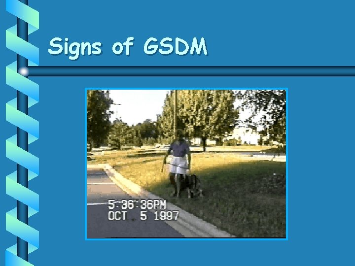 Signs of GSDM 