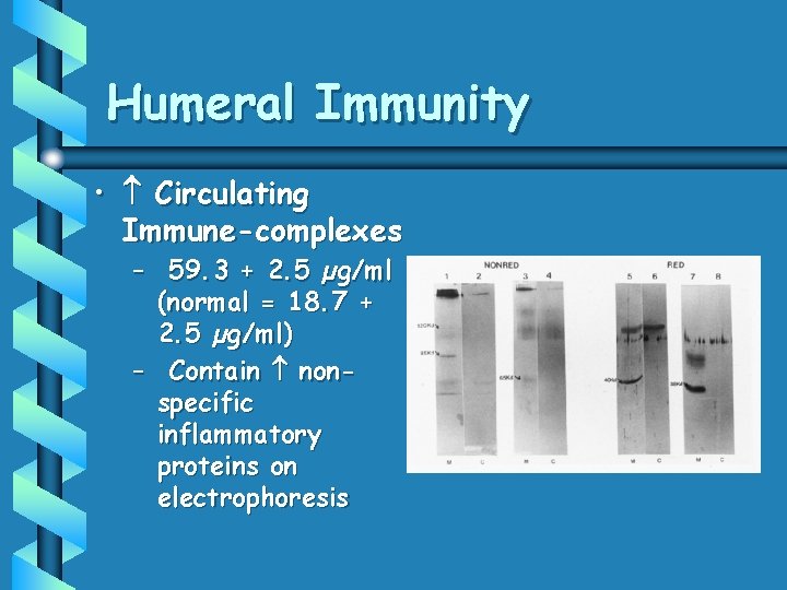 Humeral Immunity • Circulating Immune-complexes – 59. 3 + 2. 5 µg/ml (normal =