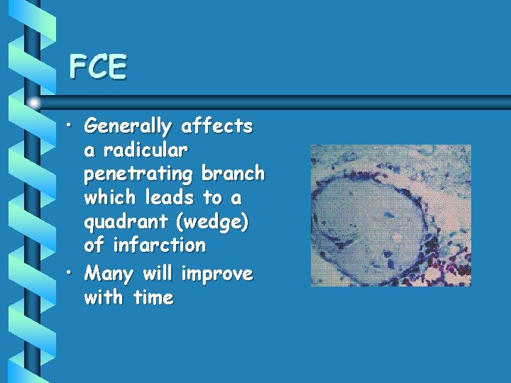 FCE • Generally affects a radicular penetrating branch which leads to a quadrant (wedge)