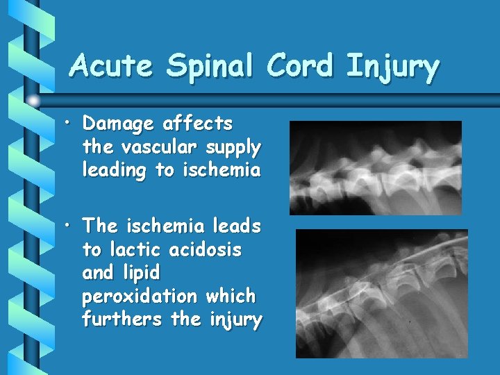 Acute Spinal Cord Injury • Damage affects the vascular supply leading to ischemia •