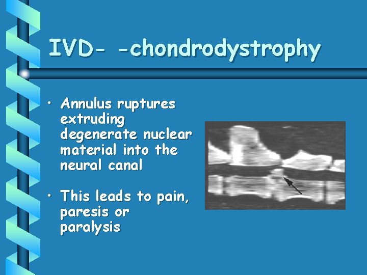 IVD- -chondrodystrophy • Annulus ruptures extruding degenerate nuclear material into the neural canal •