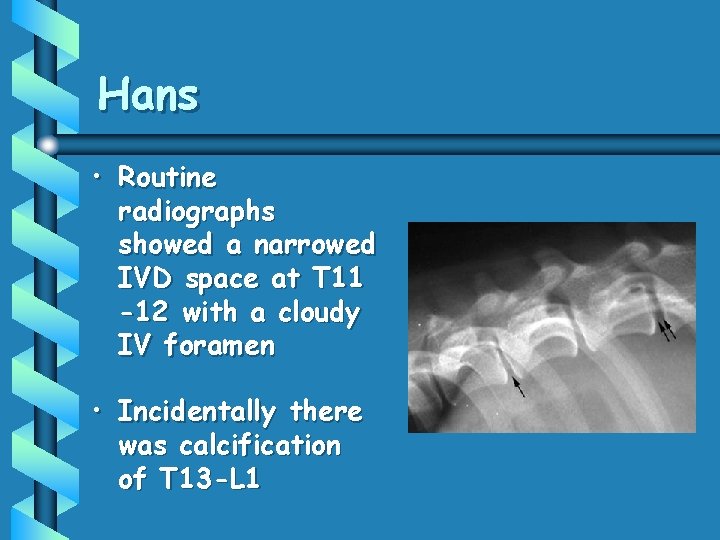 Hans • Routine radiographs showed a narrowed IVD space at T 11 -12 with