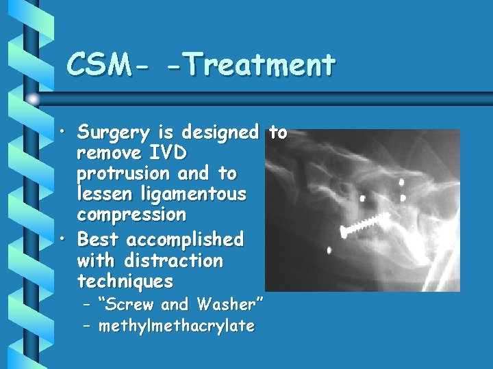 CSM- -Treatment • Surgery is designed to remove IVD protrusion and to lessen ligamentous