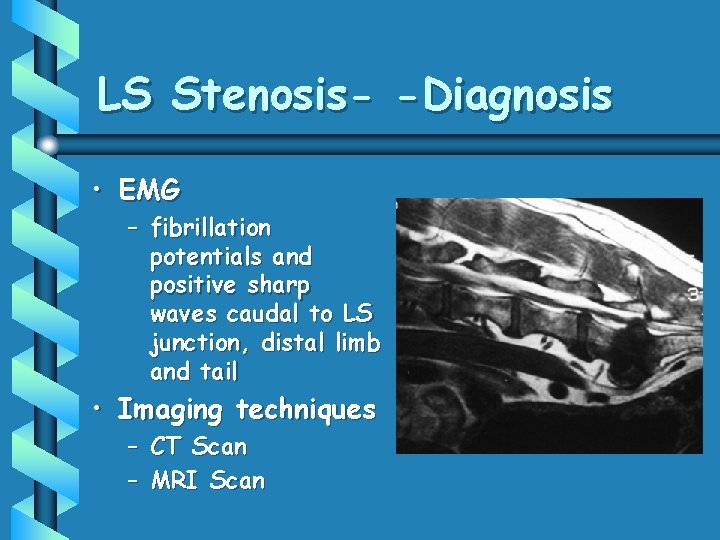 LS Stenosis- -Diagnosis • EMG – fibrillation potentials and positive sharp waves caudal to