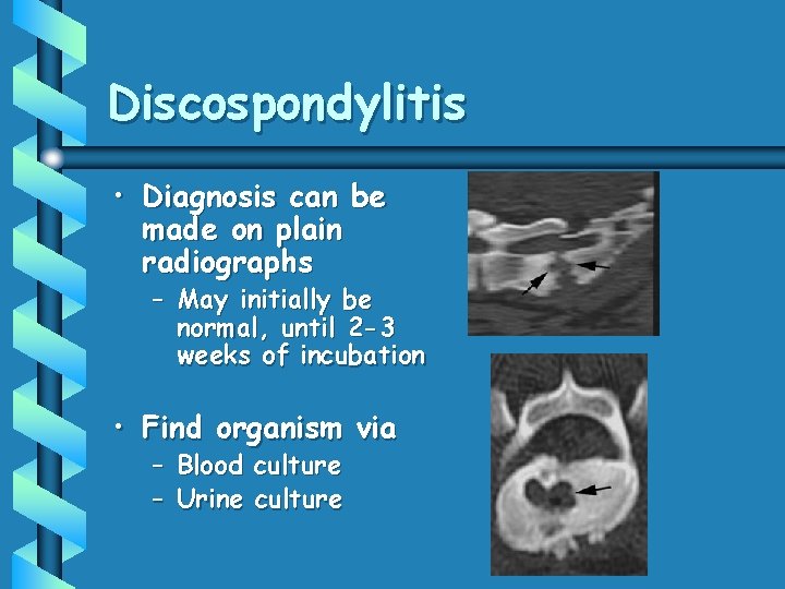 Discospondylitis • Diagnosis can be made on plain radiographs – May initially be normal,