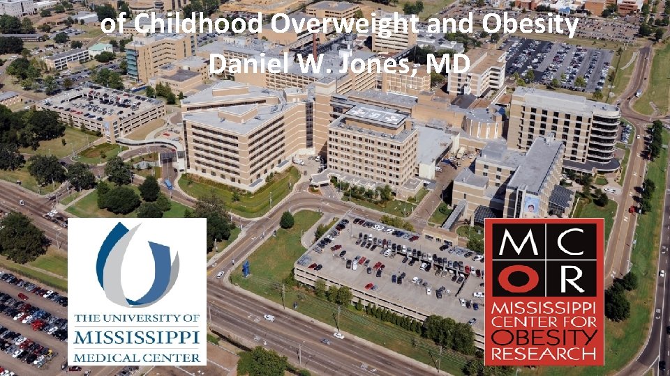 of Childhood Overweight and Obesity Daniel W. Jones, MD 