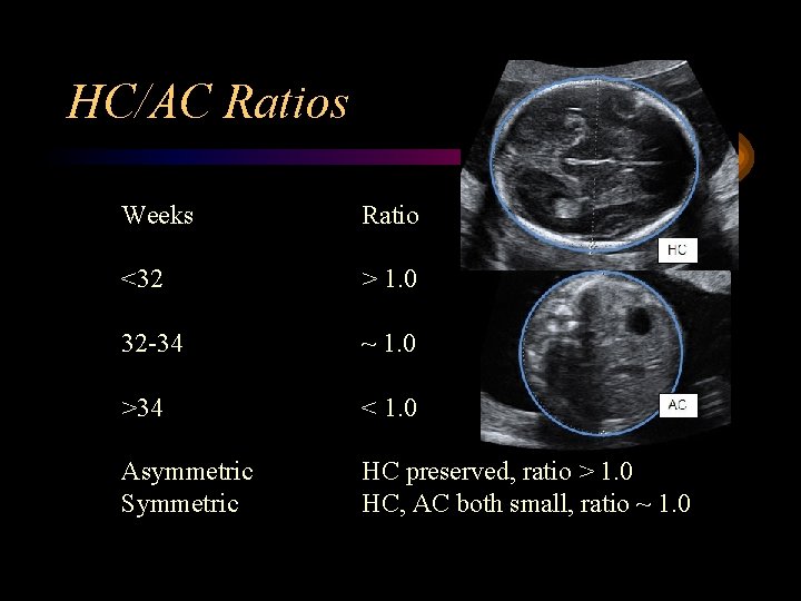 HC/AC Ratios Weeks Ratio <32 > 1. 0 32 -34 ~ 1. 0 >34