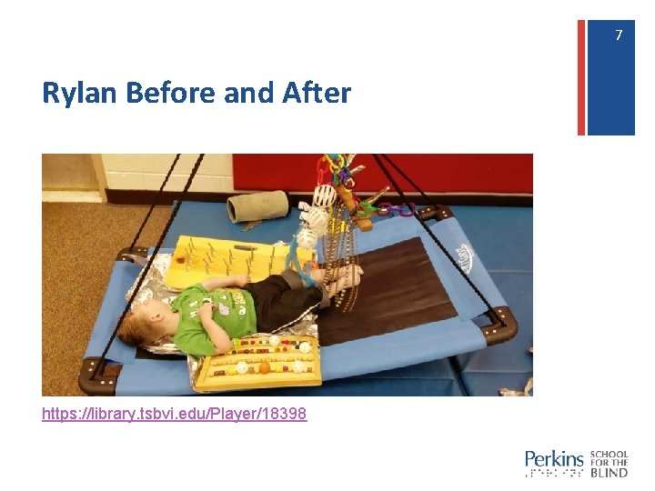 7 7 Rylan Before and After https: //library. tsbvi. edu/Player/18398 7 7 Rylan Before and After https: //library. tsbvi. edu/Player/18398