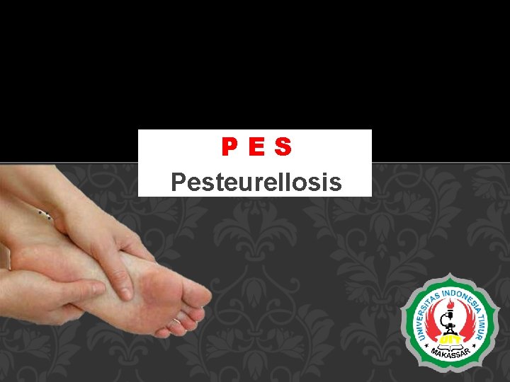 PES Pesteurellosis 