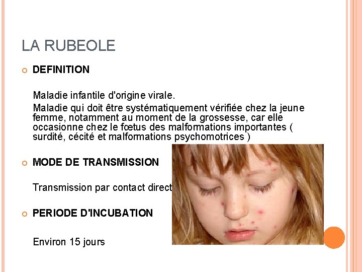 LA RUBEOLE DEFINITION Maladie infantile d'origine virale. Maladie qui doit être systématiquement vérifiée chez