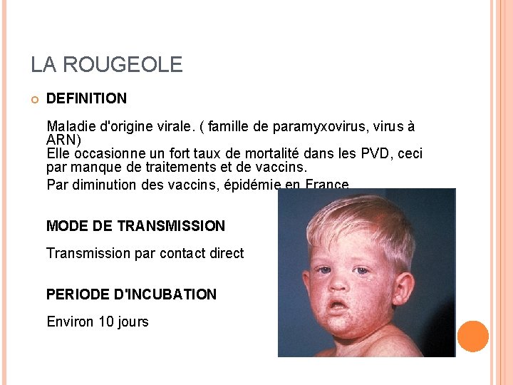 LA ROUGEOLE DEFINITION Maladie d'origine virale. ( famille de paramyxovirus, virus à ARN) Elle