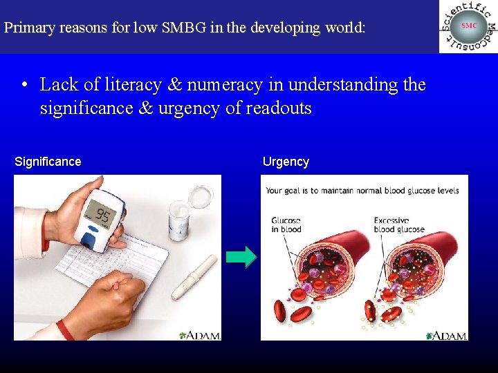 Primary reasons for low SMBG in the developing world: • Lack of literacy &