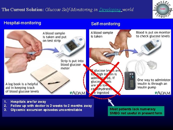 The Current Solution: Glucose Self-Monitoring in Developing world Hospital-monitoring 1. 2. 3. Self-monitoring Hospitals