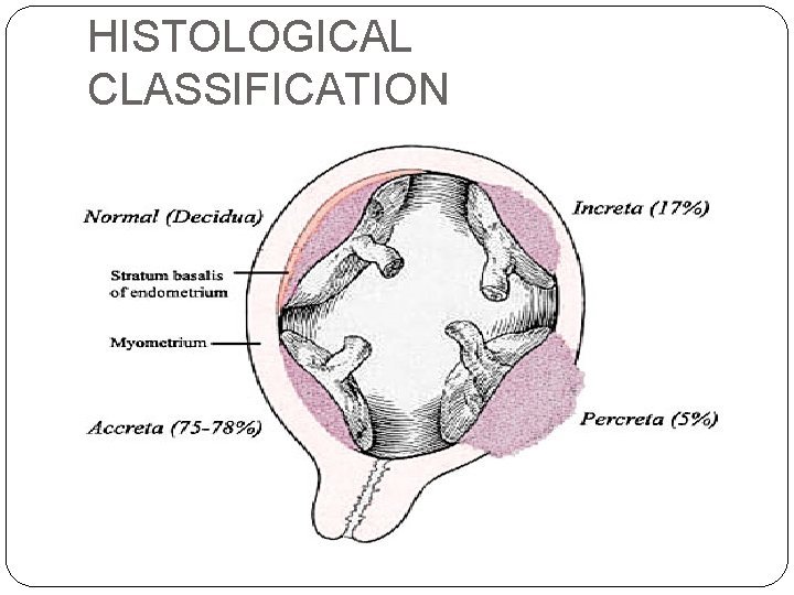HISTOLOGICAL CLASSIFICATION 