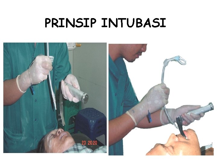 PRINSIP INTUBASI 