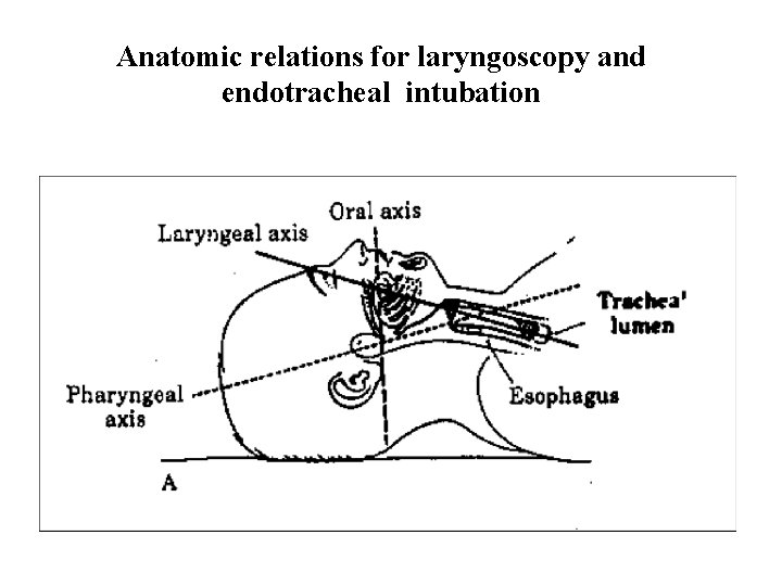 Anatomic relations for laryngoscopy and endotracheal intubation 