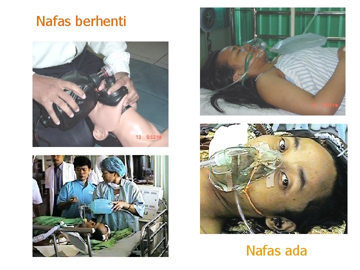 Nafas berhenti Nafas ada 