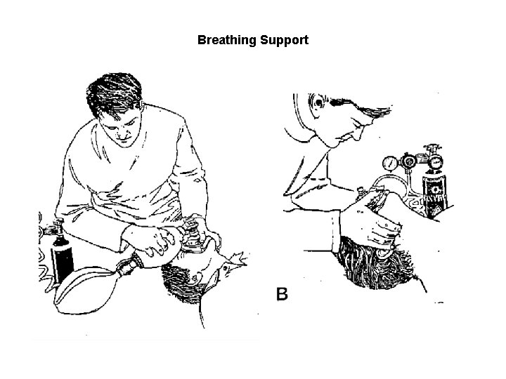 Breathing Support 