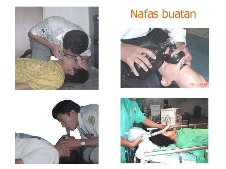 Nafas buatan 