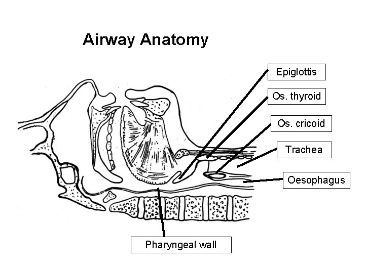 Airway Anatomy Epiglottis Os. thyroid Os. cricoid Trachea Oesophagus Pharyngeal wall 