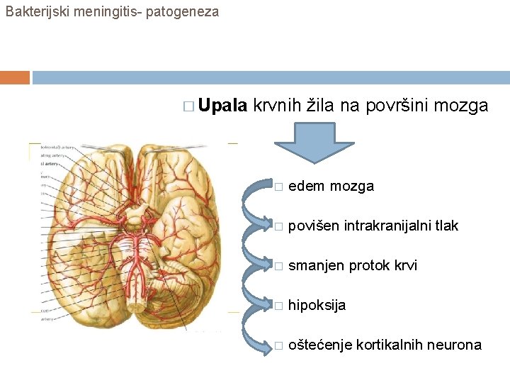 Bakterijski meningitis- patogeneza � Upala krvnih žila na površini mozga � edem mozga �