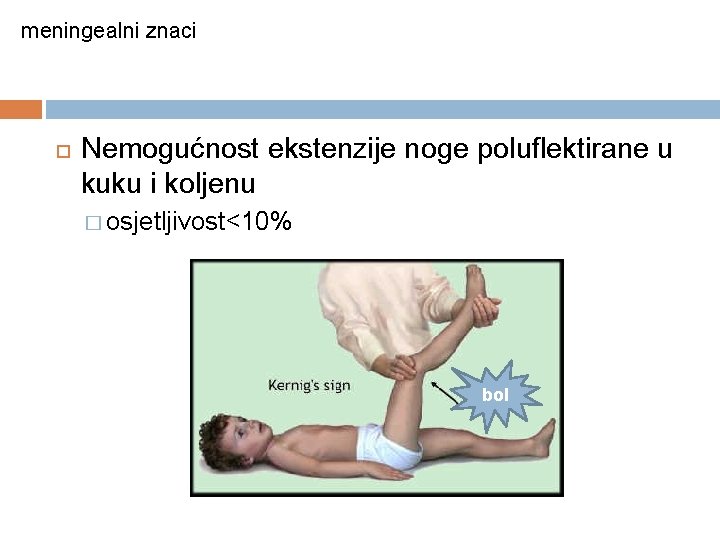 meningealni znaci Nemogućnost ekstenzije noge poluflektirane u kuku i koljenu � osjetljivost<10% bol 