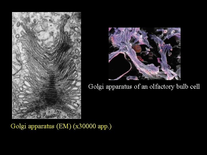Golgi apparatus of an olfactory bulb cell Golgi apparatus (EM) (x 30000 app. )