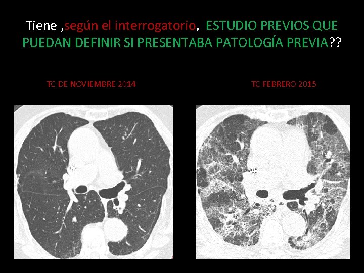 Tiene , según el interrogatorio, ESTUDIO PREVIOS QUE PUEDAN DEFINIR SI PRESENTABA PATOLOGÍA PREVIA?