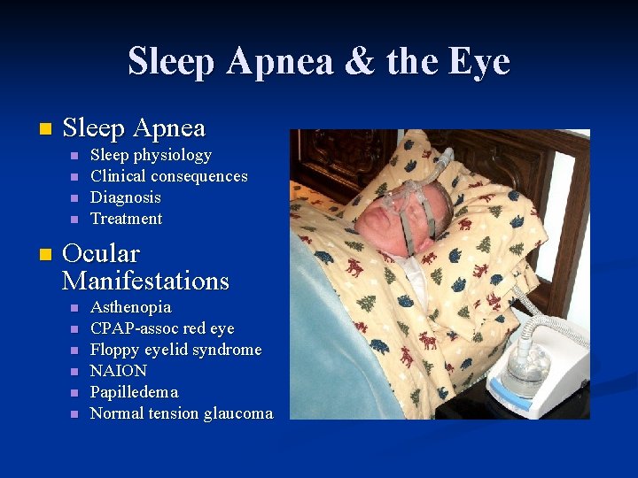 Sleep Apnea & the Eye n Sleep Apnea n n n Sleep physiology Clinical