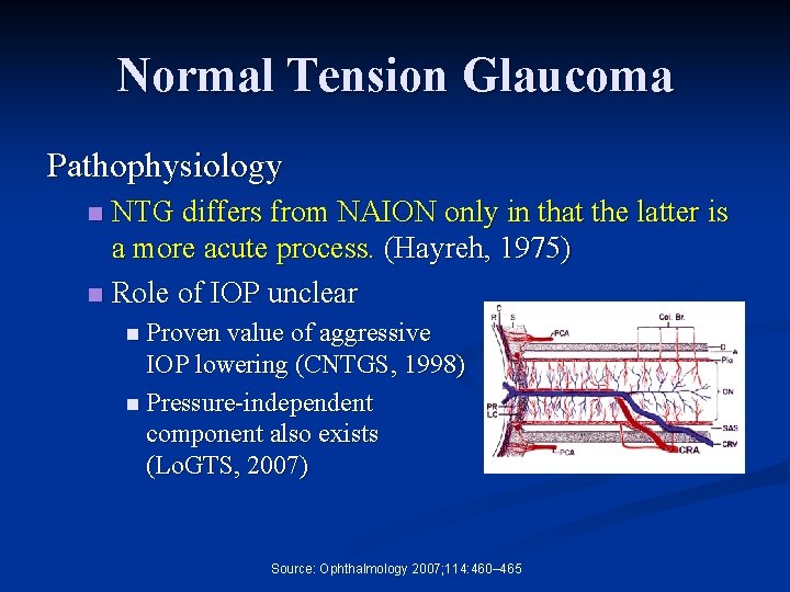 Normal Tension Glaucoma Pathophysiology NTG differs from NAION only in that the latter is